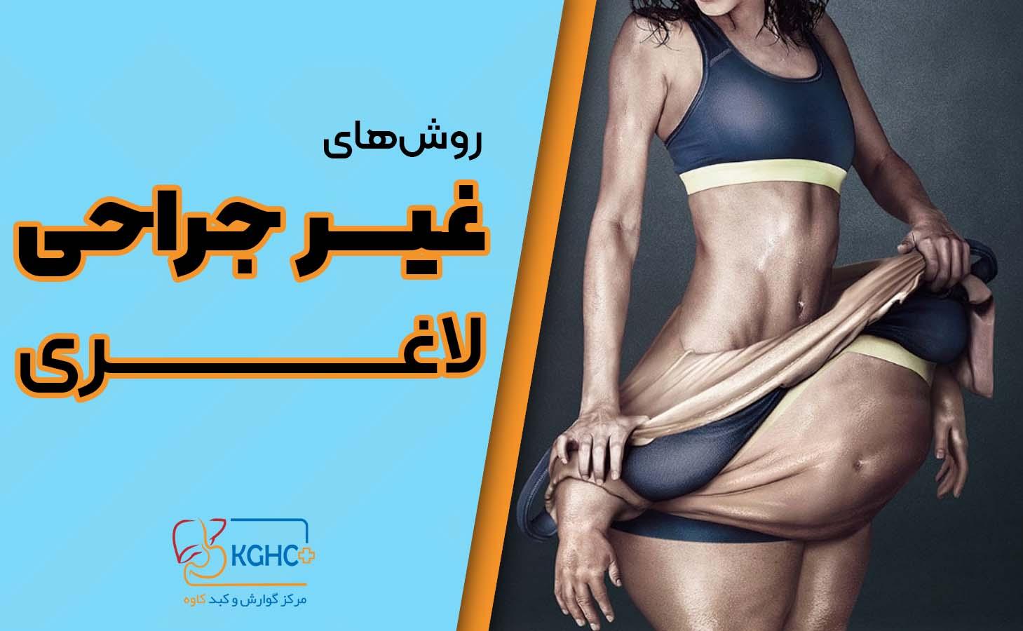 روشهای غیر جراحی لاغری