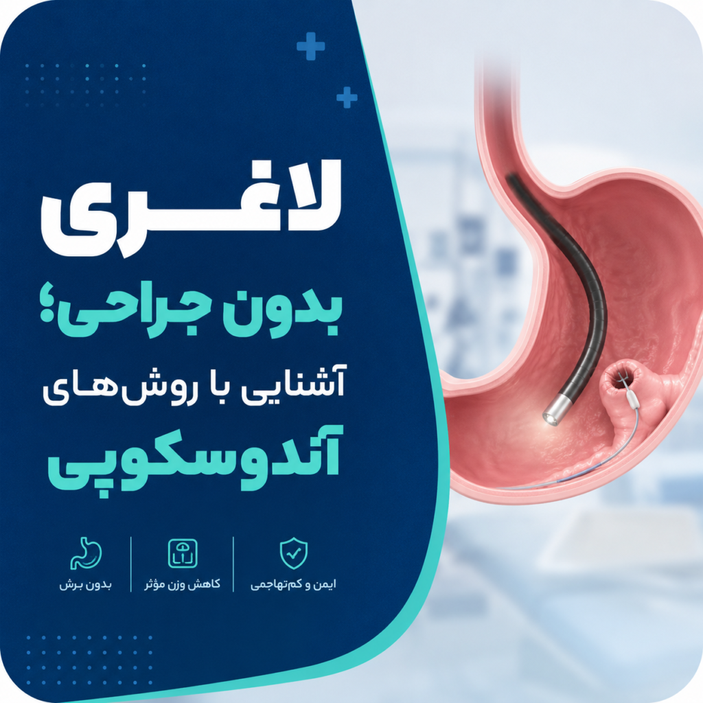 لاغری بدون جراحی؛ آشنایی با روش‌های آندوسکوپی
