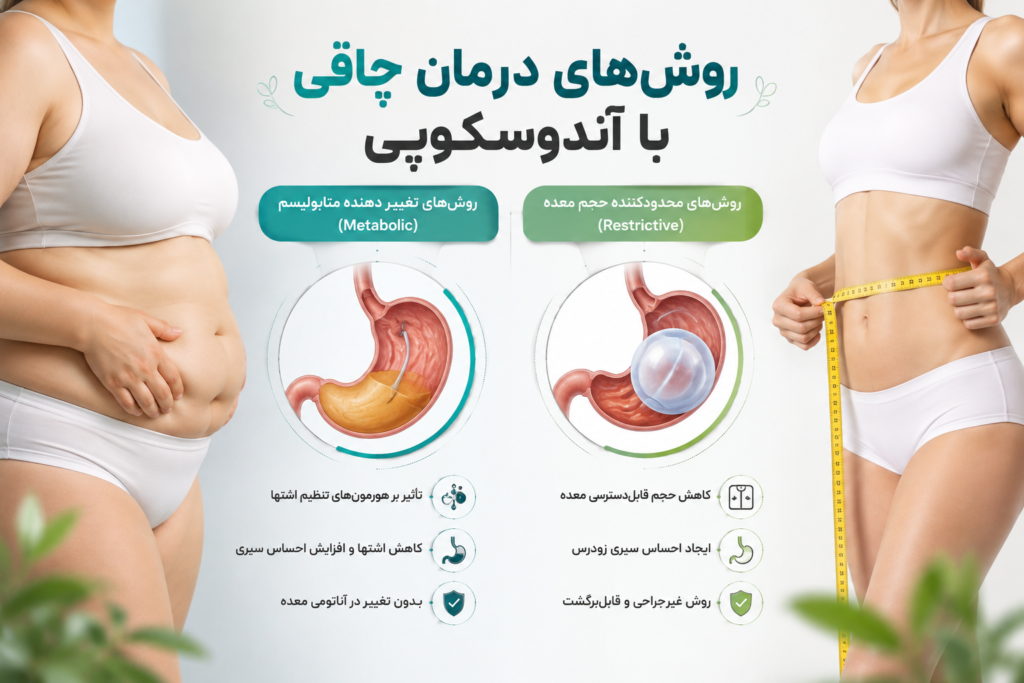 لاغری بدون جراحی؛ آشنایی با روشهای آندوسکوپی