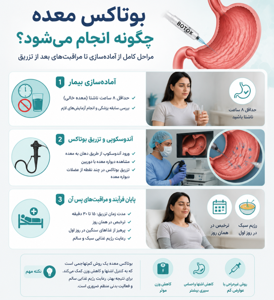 بوتاکس معده چگونه انجام میشود