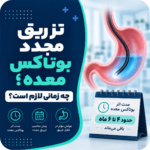 تزریق مجدد بوتاکس معده؛ چه زمانی لازم است؟