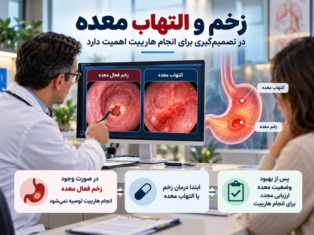 آیا رفلاکس معده مانع انجام هاربیت است؟